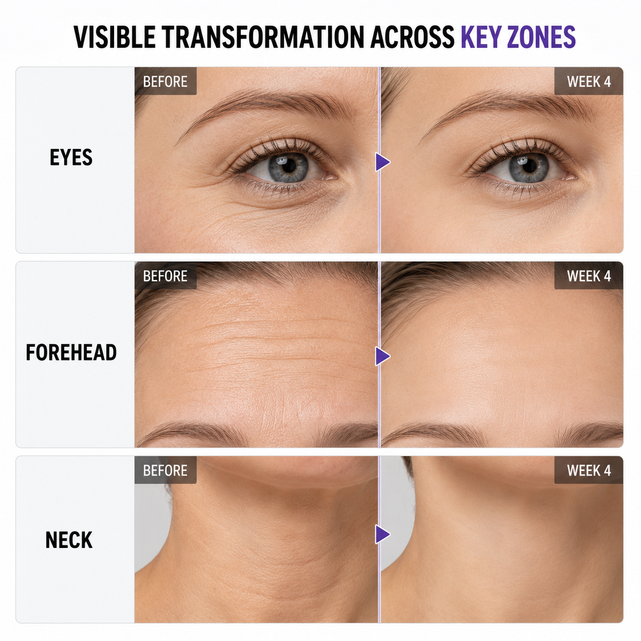 Targets All Types of Wrinkles for Younger-Looking Skin – Ultimate Collagen Firming Cream -XXS